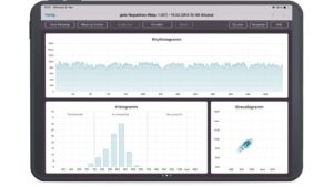 VNS Analyse Messung einer guten HRV im Rhythmo-, Histo- und Streudiagramm