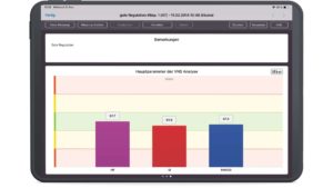 Diagramm einer VNS Analyse mit guter Regulation